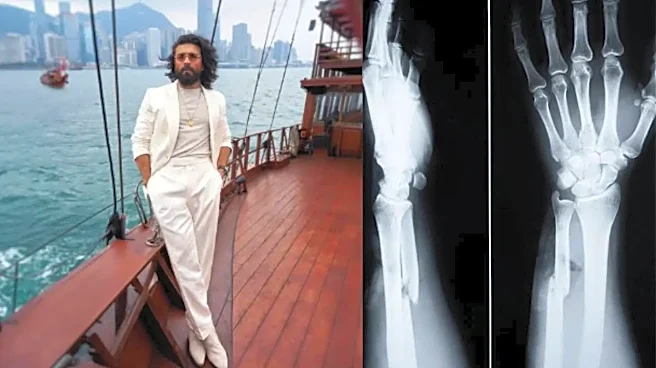 Ram Charan's Wrist Surgery a Success: How Long Does Recovery Really Take?