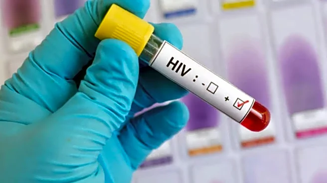 Alarming Rise in HIV Cases in West Bengal’s Bardhaman: 30 High-Profile Individuals Tested Positive