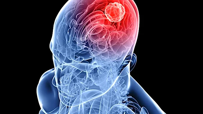 India's Brain Cancer Breakthrough? High-Grade Glioma Survival Jumps By Up To 50%
