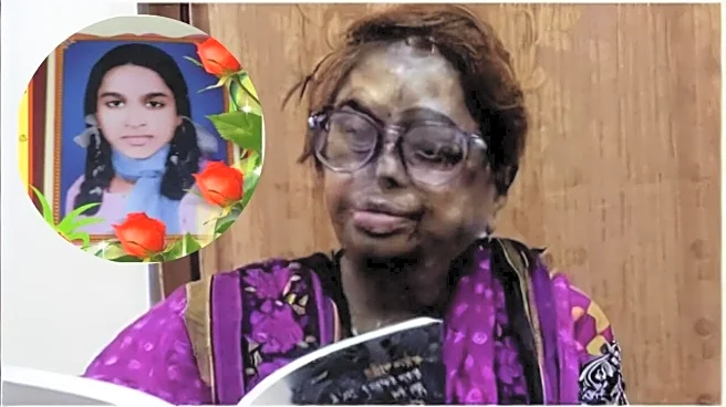 Meet Mangala Kapoor: She Was Just 12 When an Acid Attack Shattered Her World—After 37 Surgeries, How She Became ‘Kashi ki Lata’