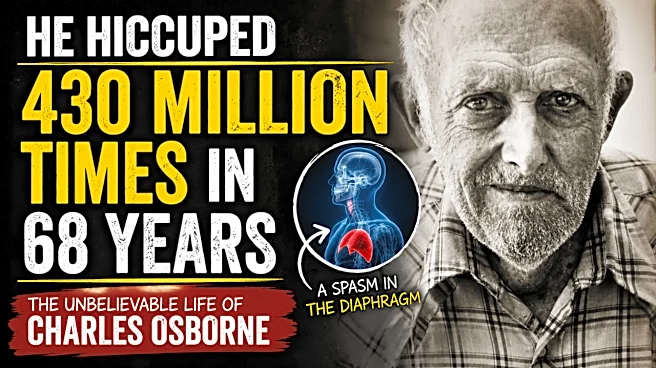 He Hiccuped 430 Million Times In 68 Years: The Unbelievable Life Of Charles Osborne