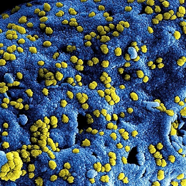 Rare amoeba infection risk flagged ahead of summer