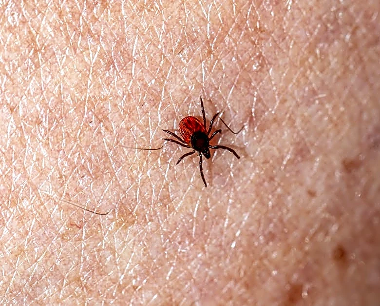 Tick Bite ER Visits Surge Ahead of Peak Summer Season