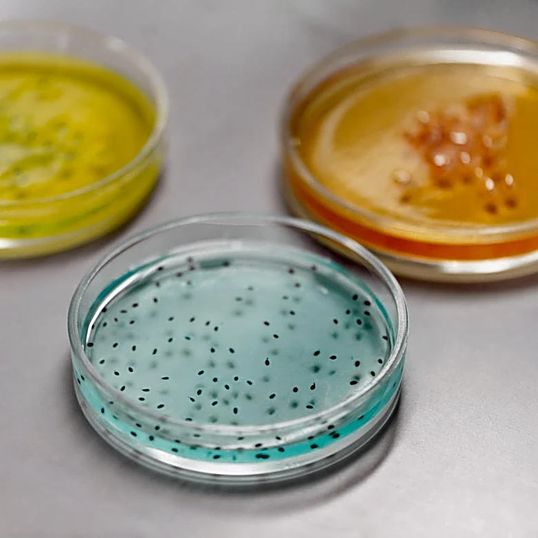 Seasonal Patterns of Foodborne Illness in the U.S.: Summer Peaks for Bacteria