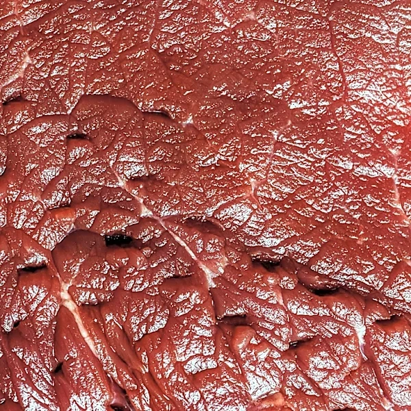 Flesh-Eating Bacteria Cases Confirmed in Florida, More Expected This Summer