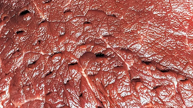 Flesh-Eating Bacteria Cases Confirmed in Florida, More Expected This Summer