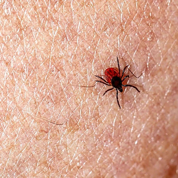 Tick-Borne Illnesses on the Rise in Asheville, NC: Pets as Key Vectors