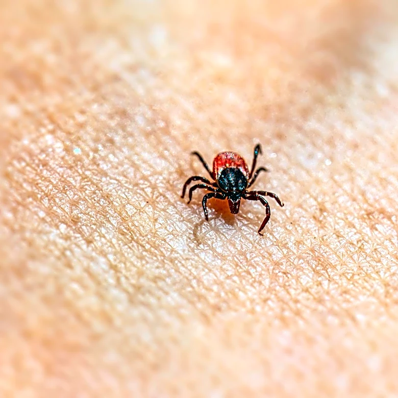 Tick Bite Cases Surge Across the U.S. Amid Rising Temperatures