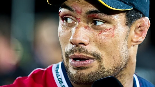 Ex-rugby player Shane Christie, who called for study of concussion, dies at age 39