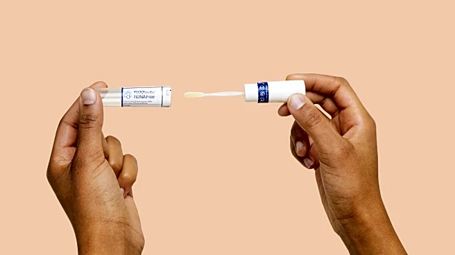 Gut microbiome tests are everywhere. Should you get one?