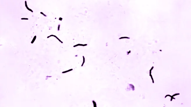 Global tuberculosis diagnoses rise to a record, but deaths fall, WHO reports