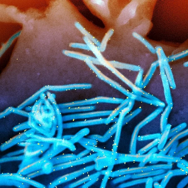 Winter virus season so far is not too bad, but doctors worry about suffering to come