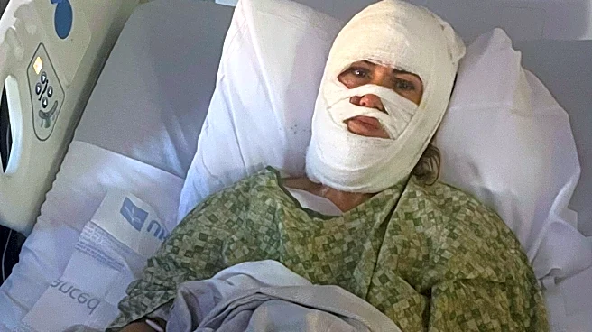 A Georgia woman suffers severe burns in a chemical attack at a Savannah park