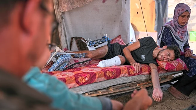 Gaza amputees struggle to rebuild lives as the enclave faces shortages of prosthetic limbs