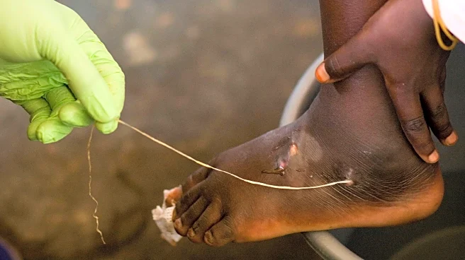 World creeps closer to eradicating human Guinea worm cases, with just 10 last year: Carter Center