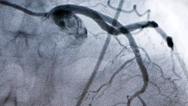 Experimental cholesterol-lowering pill may offer new option for millions