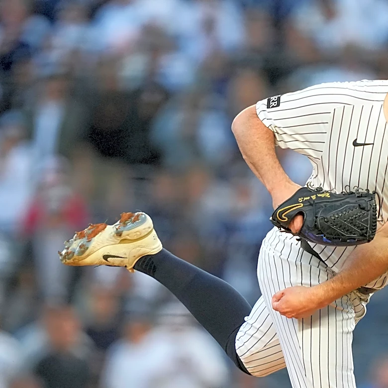 Yankees left-hander Carlos Rodón thinks his tight right hamstring is only a minor setback
