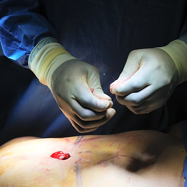 Cosmetic interventions are booming. Many say ethical conversations are lagging
