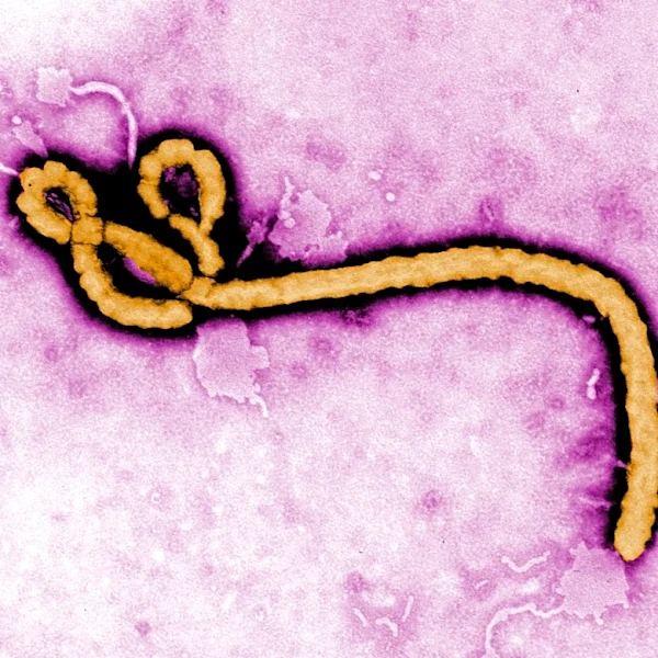 A look at major Ebola outbreaks and when the disease was first identified