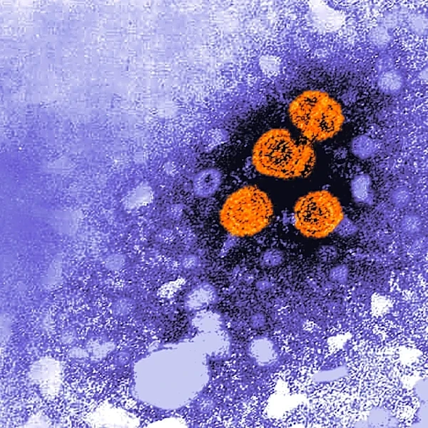 Experimental hepatitis B drug may offer 'functional cure' for some patients