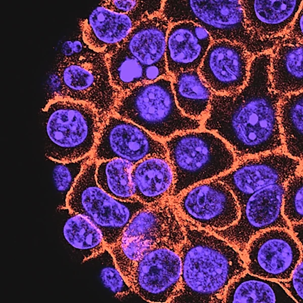 Experimental pill promises new hope for deadly pancreatic cancer