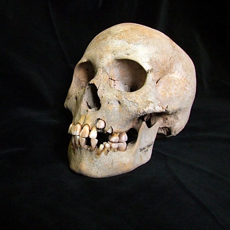 Ancient teeth from Siberia rewrite the plague’s timeline, dating back to over 5,500 years ago