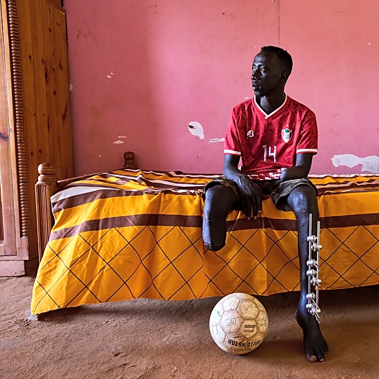 The scars of war among survivors in Sudan