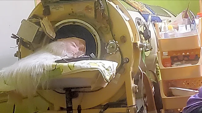 Martha Lillard, last US polio patient using iron lung, dies at 78 in Oklahoma