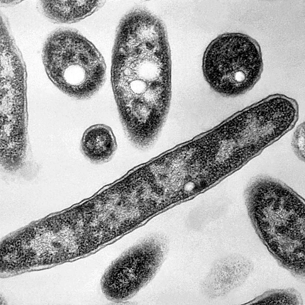 New diagnoses slow in NYC Legionnaires' disease outbreak; source still unclear