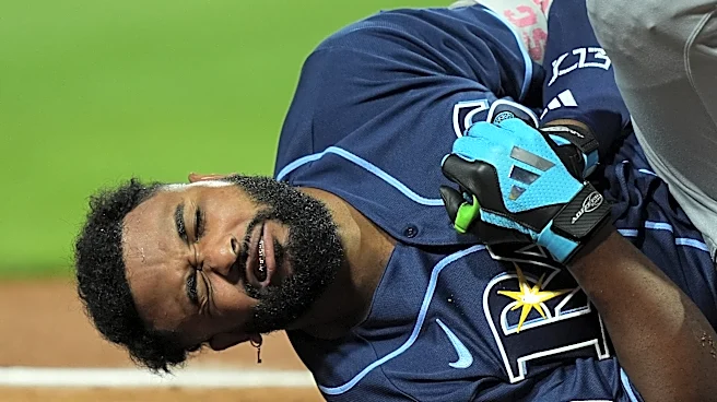 Tampa Bay Rays slugger Junior Caminero leaves All-Star Game after being hit on left hand