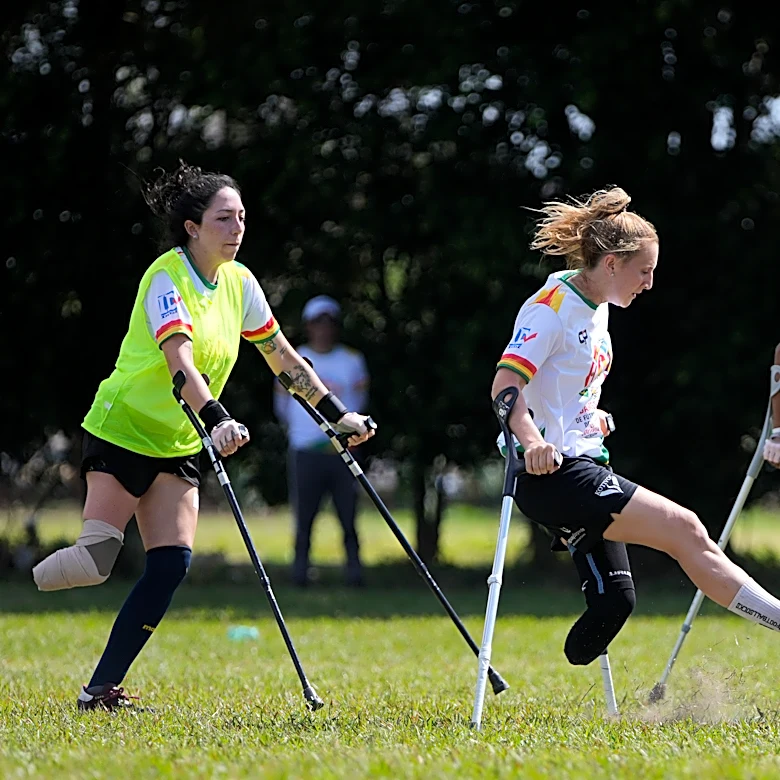 Women amputees in South America train to be World Cup soccer contenders