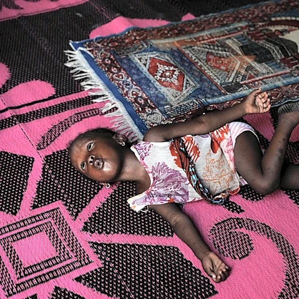 Nigerian children pay the price for the Iran war as malnutrition and poverty surge