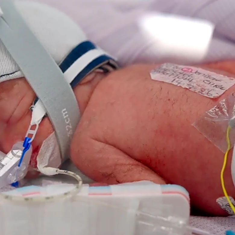 An Australian woman gives birth to rare identical quadruplet girls