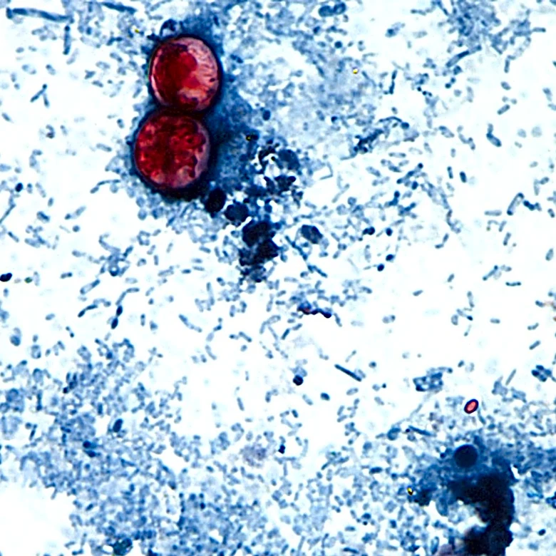 Michigan reports the first 2 US deaths related to a diarrhea-causing parasite