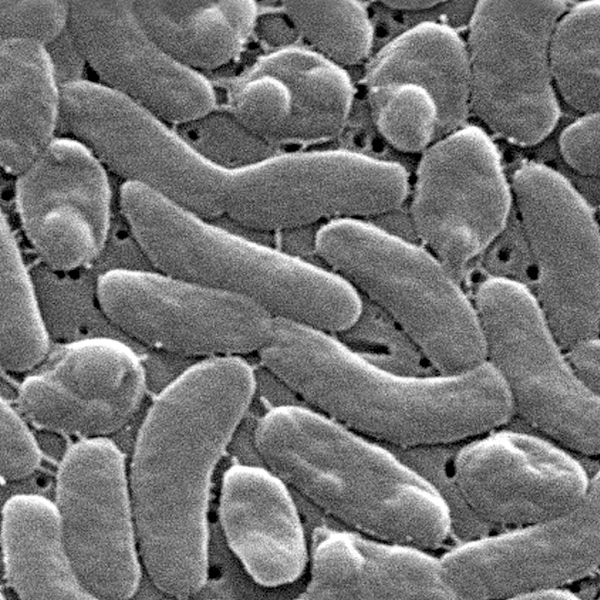 Health officials urge caution for Gulf Coast beachgoers during surge of deadly bacterial infections