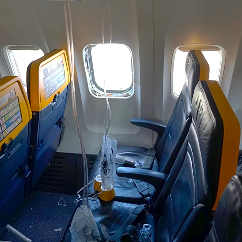Broken engine parts shattered the Ryanair plane window that a man's head got sucked into: NTSB