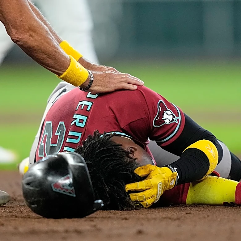 Arizona’s Perdomo leaves game with head contusion after being hit in the helmet by a line drive
