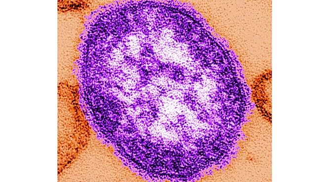 Pennsylvania officials report state's 3rd death involving measles
