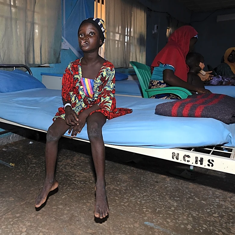 Free operations give hope to children with a neglected but deadly disease in Africa