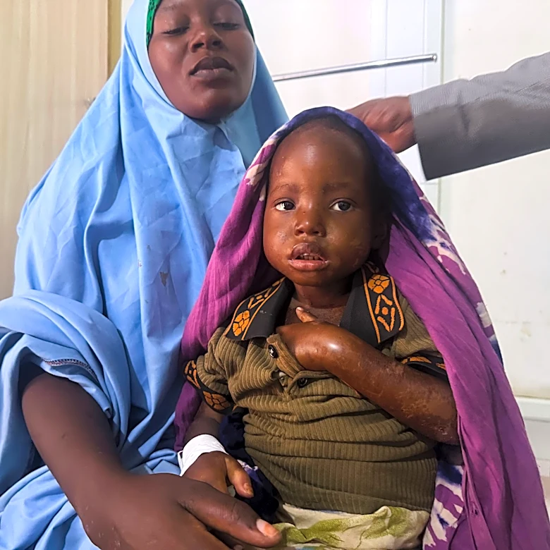 Mother's 3-day walk with sick daughter highlights Somalia's child malnutrition emergency