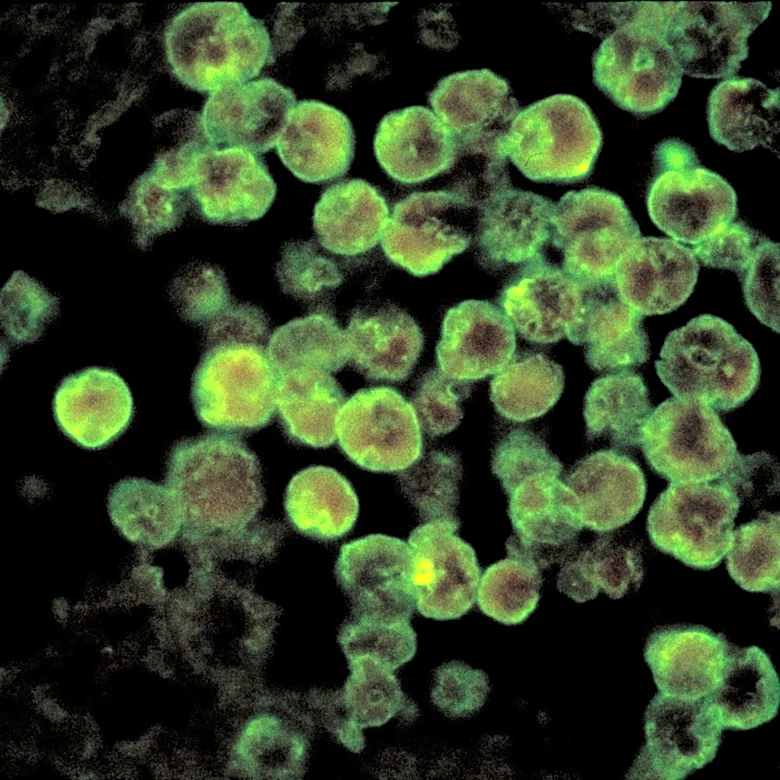 Likely source of NC brain-eating amoeba that killed teen determined