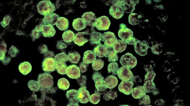 Likely source of NC brain-eating amoeba that killed teen determined
