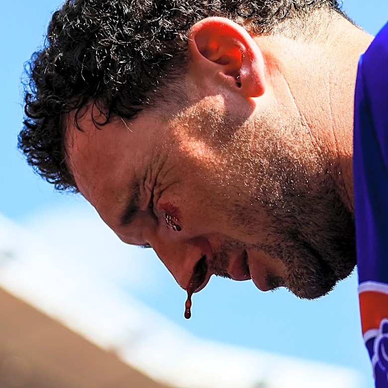 Cubs' Alex Bregman struck in face by line drive, exits game vs. Reds