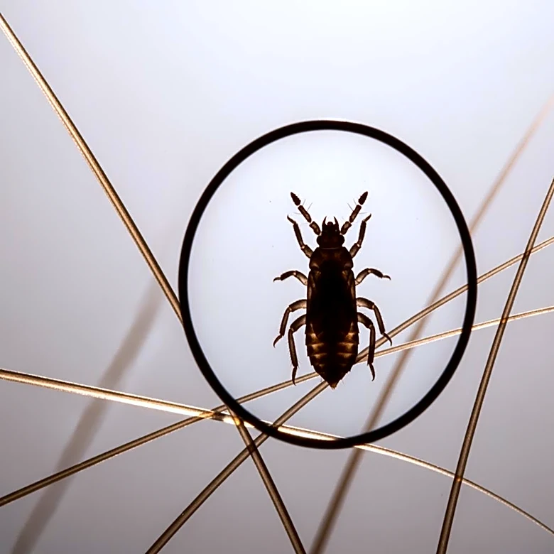 The Most Effective Ways to Treat Head Lice