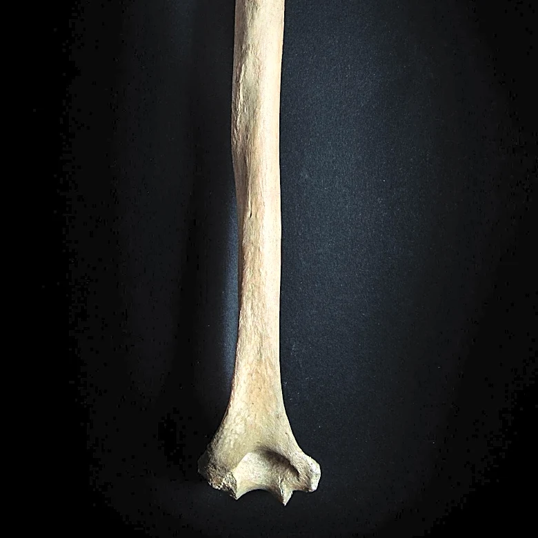 How the Hamstring Became a Focus in Sports Medicine