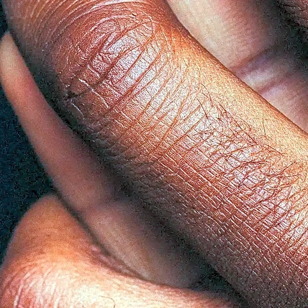 Skin Barrier Repair Explained: What Your Skin Actually Needs