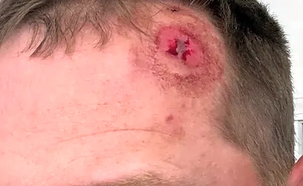 Michigan golf pro 'really fortunate' after being KO'd by ball to head