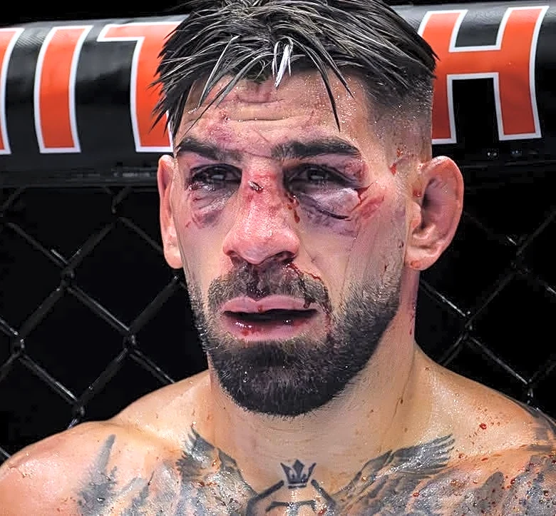 Islam Makhachev hopes Ilia Topuria rebounds from Justin Gaethje loss