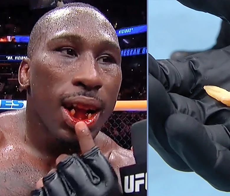 UFC 330 video: Tresean Gore shows off missing teeth after beating Vicente Luque