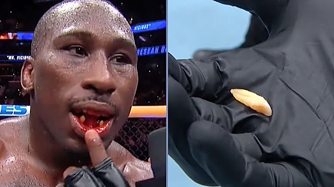 UFC 330 video: Tresean Gore shows off missing teeth after beating Vicente Luque